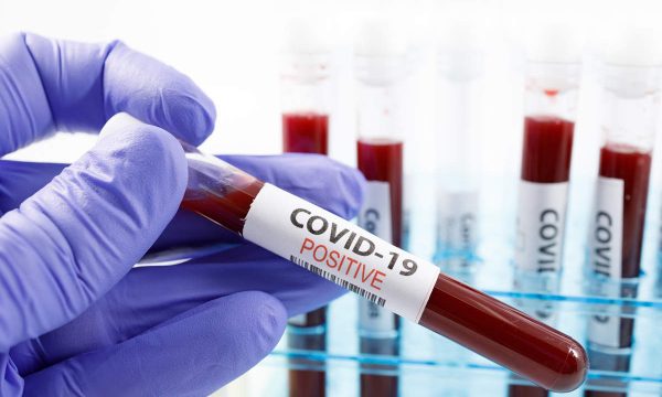 Covidi-19 futet në Vetëvendosje, infektohet deputeti i parë