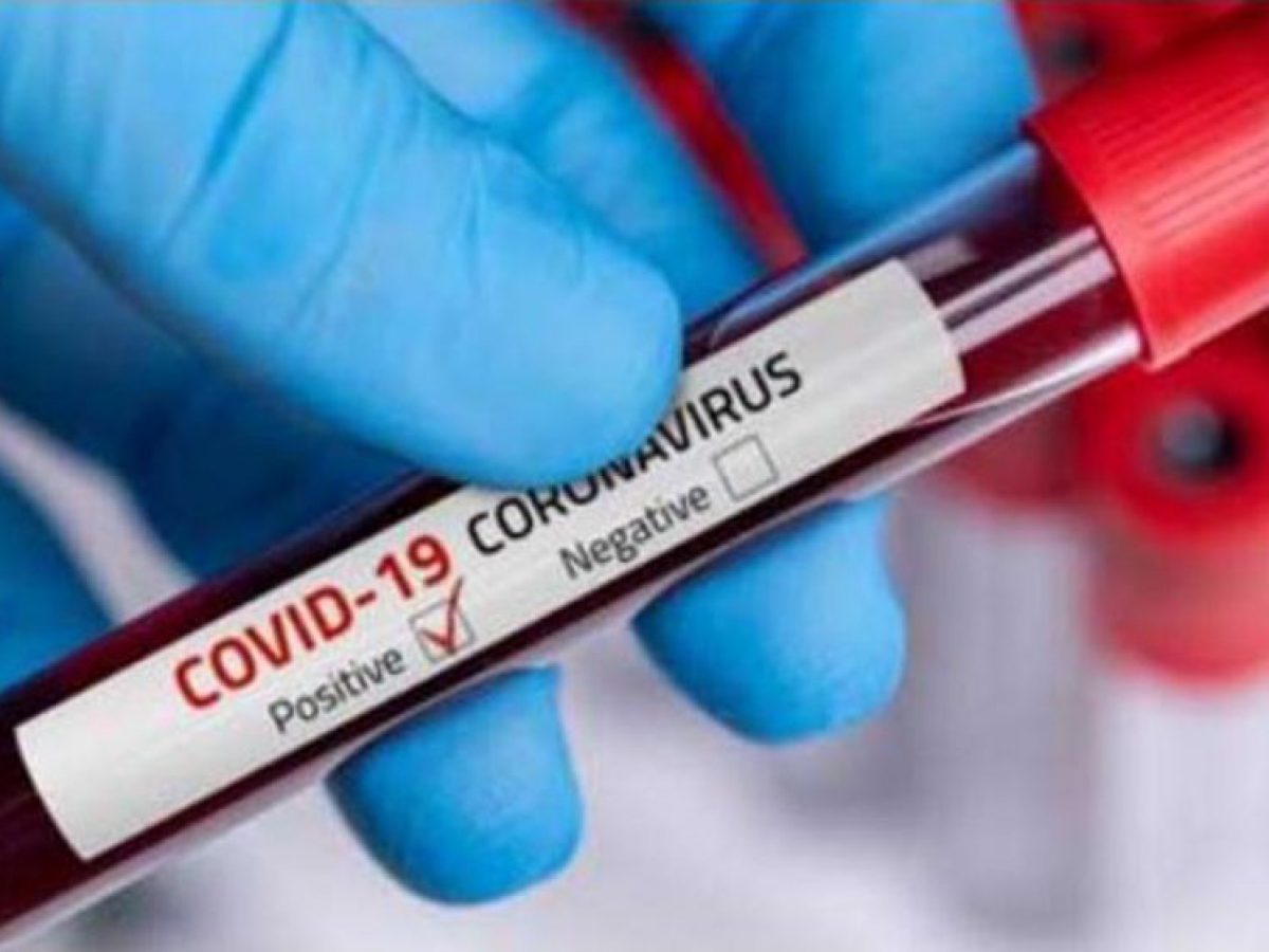 13 raste pozitive me coronavirus në Suharekë