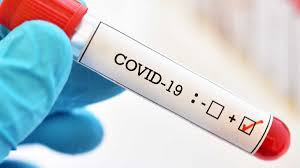 Tre të vdekur dhe 461 raste pozitive me coronavirus për 24 orë