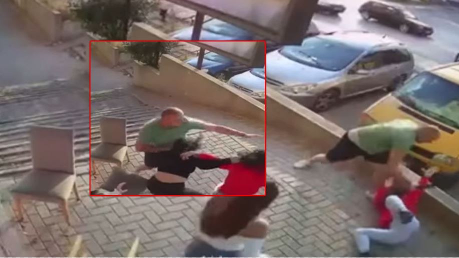 Flet njëra nga vajzat që u rrah në Prishtinë: Burri që na sulmoi kërkonte shërbime jashtë masazhit